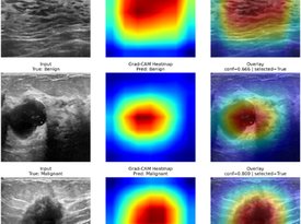 Bayesian deep learning with selective inference for uncertainty-aware breast ultrasound classification