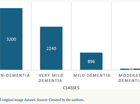 Discrimination of Alzheimer’s Diseases