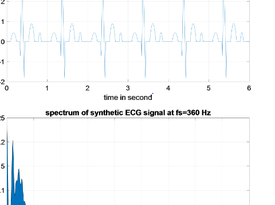 A Wavelet-Based Architecture for Efficient ECG Signal Denoising