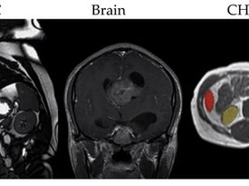 A Comparative Study of Generative Adversarial Networks in Medical Image Processing