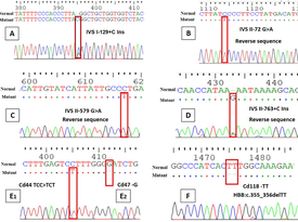 Complete molecular spectrum of β-globin gene mutations via direct sequencing identifies seven novel variants in β-thalassemia major